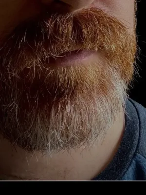 The Hairy Ginger
